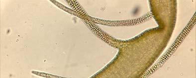 microscopio. - Siphononocladales (es.