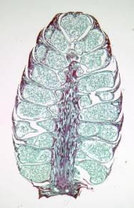 Le infiorescenze strobiliformi