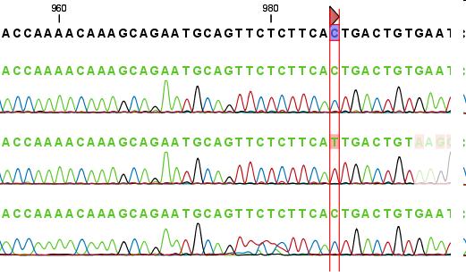 Sostituzione di una base nucleotidica