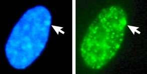 I nuclei delle cellule somatiche femminili contengono un Corpo di Barr (indicato dalle frecce in figura), un cromosoma X inattivo condensato, che si localizza