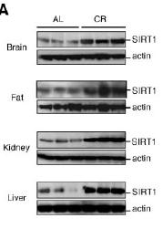 Caloric restriction increases SIRT1 expression in a