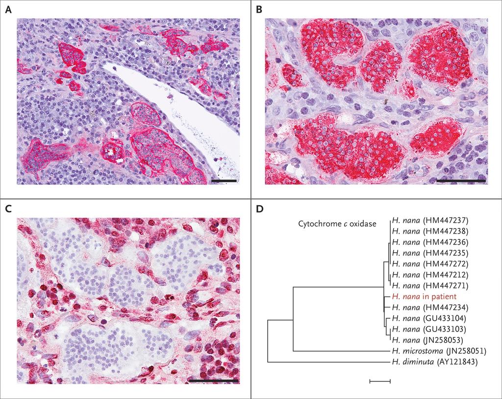 Confirmation of H. nana Infection.