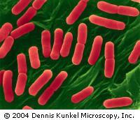 Batteri Gram-negativivi Escherichia coli al m. o.