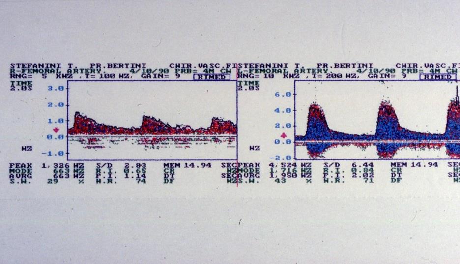 Color-Doppler III