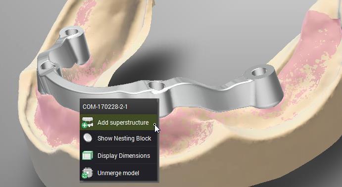 1.4 Sovrastruttura per Barre * L utilizzatore CARES può creare una Sovrastruttura su Barre per protesi