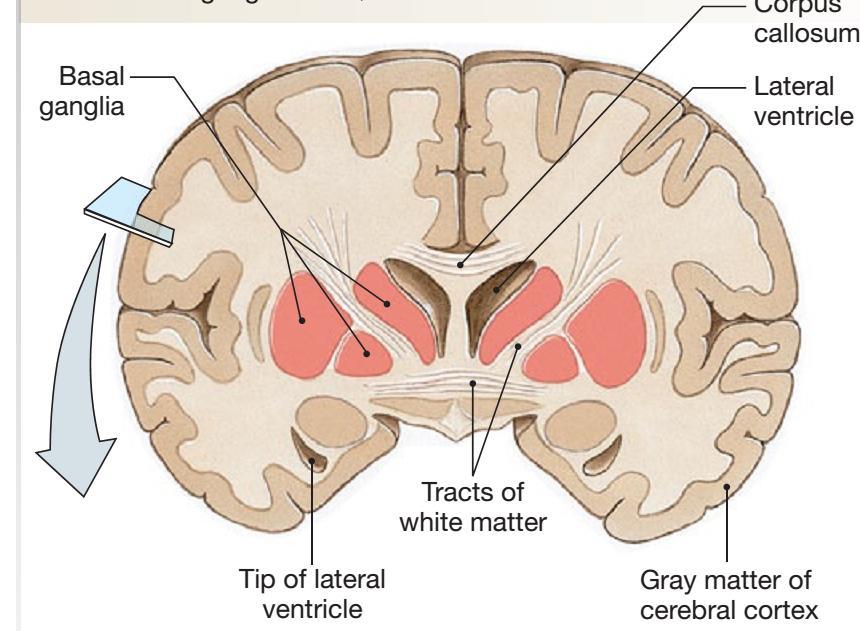 Materia grigia: somi neuronali, dendriti, assoni amielinici Corteccia cerebrale (2200 cm 2, volume 600 cm 3,