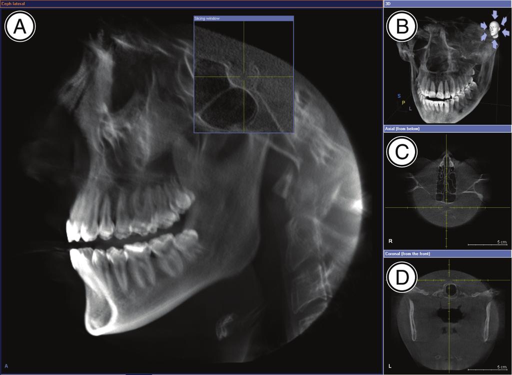 6 Aree di lavoro Sirona Dental Systems GmbH Area di lavoro "Detail" Viste A Ceph Laterale B Vista 3D [ 23] C D Piano assiale Piano coronale 6.