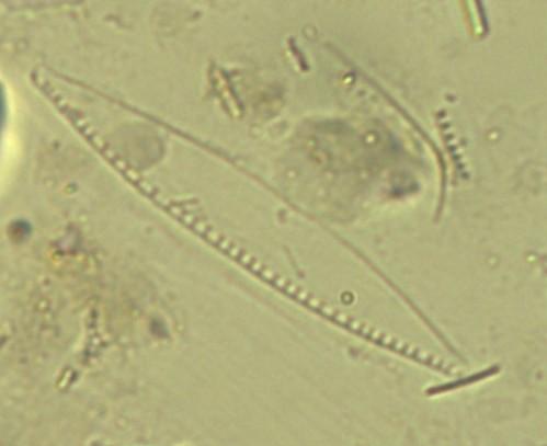 parvulum e Nitzschia inconspicua nel prelievo estivo, Achnanthidium eutrophilum e Cymbella excisa nel prelievo autunnale.