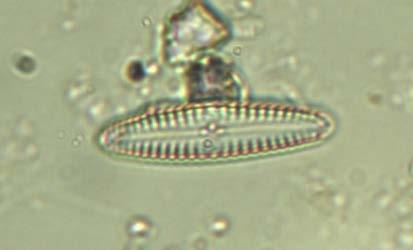Nel campionamento autunnale il numero totale di specie di diatomee rinvenute è 23; le specie più abbondanti risultano Gomphonema parvulum, con un conteggio di 154 valve, e Planothidium