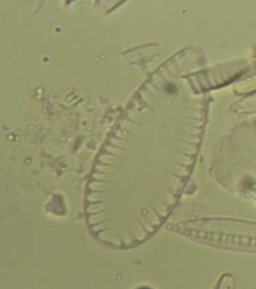 Nel campionamento autunnale il numero totale di specie di diatomee rinvenute è 21; le specie più abbondanti risultano Achnanthidium eutrophilum, con un conteggio di 254 valve, e Navicula veneta, con