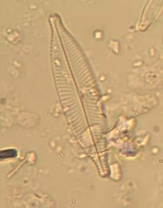Nel campionamento autunnale il numero totale di specie di diatomee rinvenute è 26; la specie più abbondante risulta ancora Planothidium frequentissimum, con un conteggio di 68 valve.