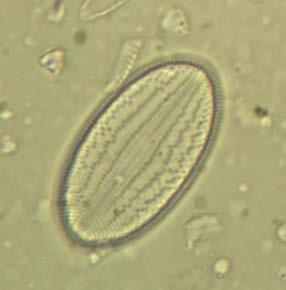 Nel campionamento autunnale il numero di specie di diatomee è sempre 31, ma la comunità risulta modificata nelle abbondanze delle specie; infatti predominano Amphora pediculus e Navicula tripunctata