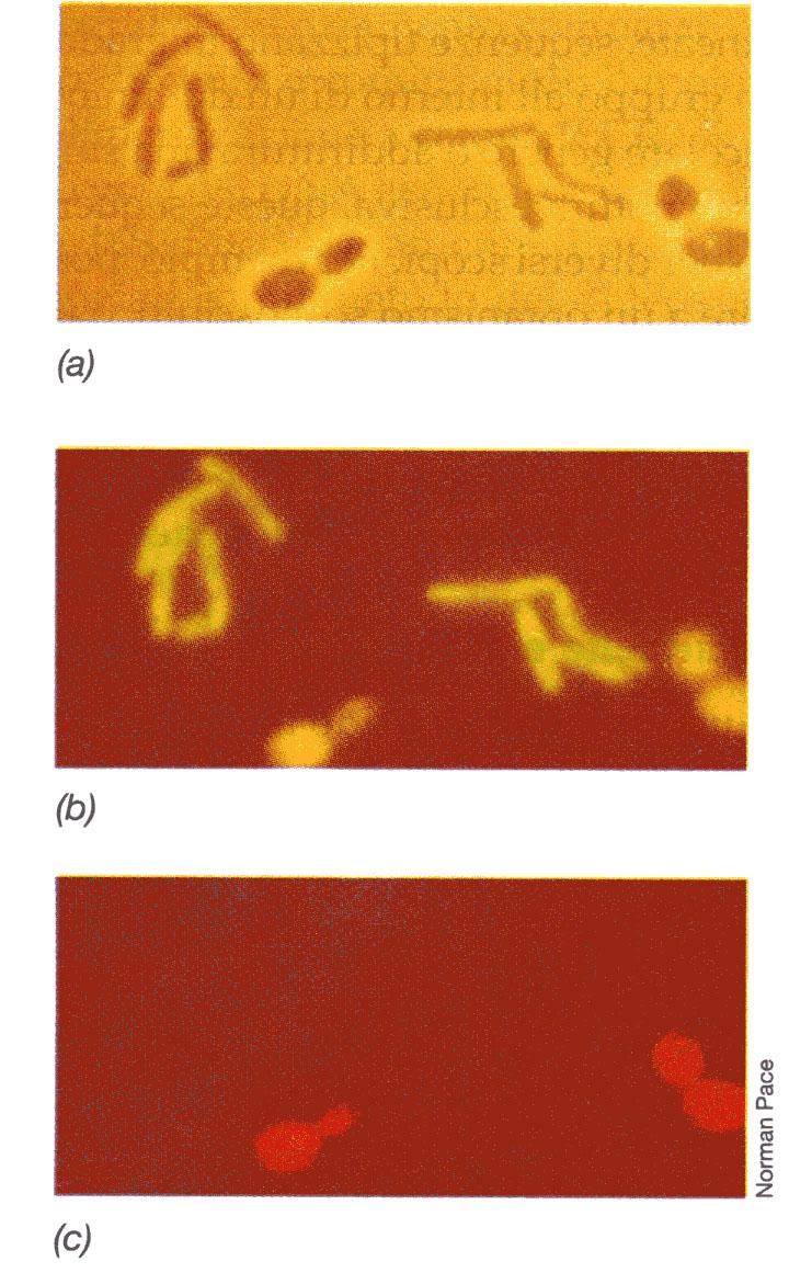 Uso di sonde molecolari a DNA FISH: