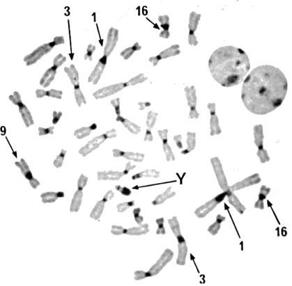 Bande C Colorano l eterocromatina costitutiva (Constitutive heterocromatin), cioè le regioni individualmente variabili (eteromorfe) Si localizzano attorno ai centromeri e sulla parte distale del
