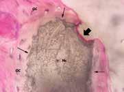 Difetti delle forcazioni Ref. 00096N CONFEZIONAMENTO Ogni confezione contiene 4 capsule da 0,5 gr. Granulometria 0,2-0,5 mm.