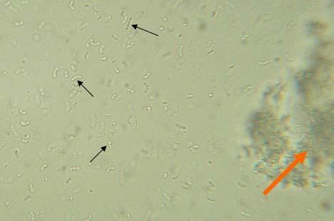 CELLULE PROCARIOTICHE Le cellule procariotiche hanno generalmente dimensioni comprese tra 0.5 e 2 µm. 1.