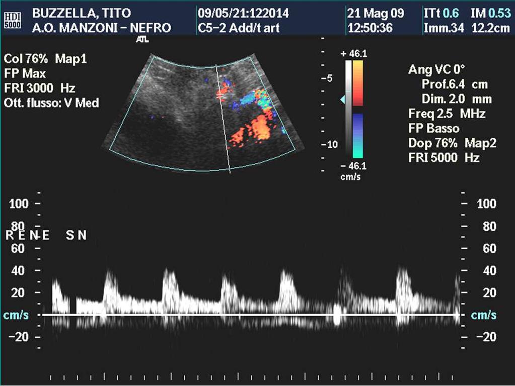 aliasing Doppler VPS a