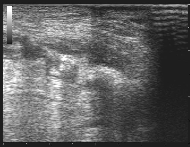 epididimo 12 Fig.