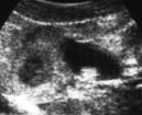 L ispessimento è dovuto alla luteinizzazione preovulatoria dei follicoli 44 Fig. 26: ovaio sinistro, sesto giorno dell estro.