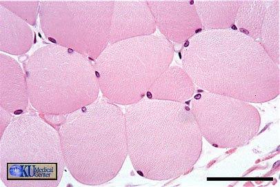 TESSUTO MUSCOLARE STRIATO Il tessuto muscolare tipicamente volontario è detto striato, o anche scheletrico, per come