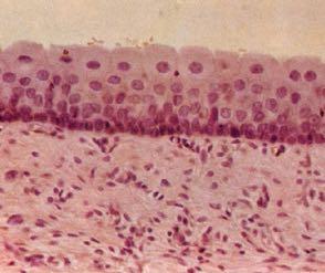 matrice amorfa gelificata con cellule mesenchimali lasso ed amorfo, matrice gelatinosa di