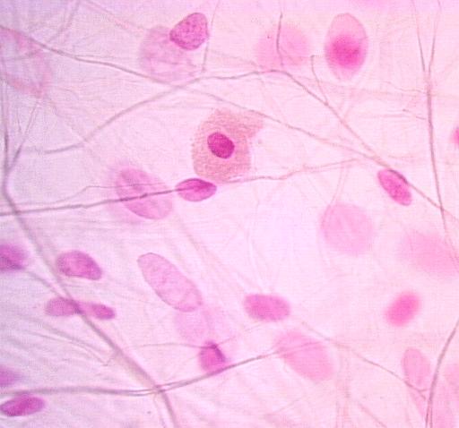 stroma di molti organi parenchimatosi (non la capsula!