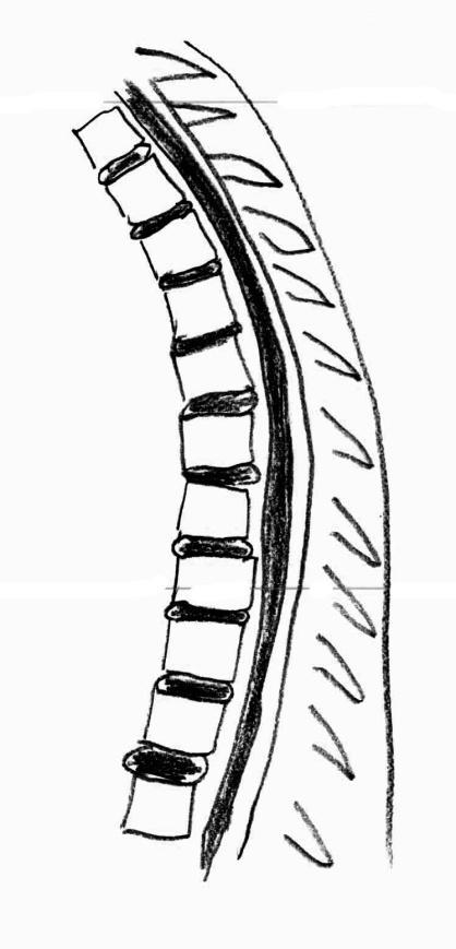 Piani di scansione Piano coronale: 16-20 strati, da 3-4mm, in assiale perpendicolari al piano sagittale mediano della vertebra, e in sagittale sostanzialmente paralleli alla schiena o