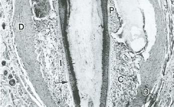 di trabecole); (C) seno venoso con trabecole; membrana vitrea (freccia); (E) guaina esterna della radice;