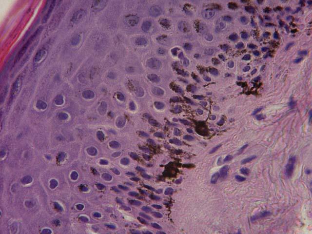 Figura 13: Sezione istologica di cute di gatto. Si nota l aspetto dendritico dei melanociti epidermici (ematossilina-eosina, 40x). 1.3.2 - MELANOCITOGENESI Nell embrione, i melanoblasti risiedono nella cresta neurale.