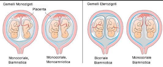 GEMELLI DIZIGOTI La gemellarità dizigota o biovulare deriva dallo sviluppo di due cellule uovo fecondate da due diversi spermatozoi.