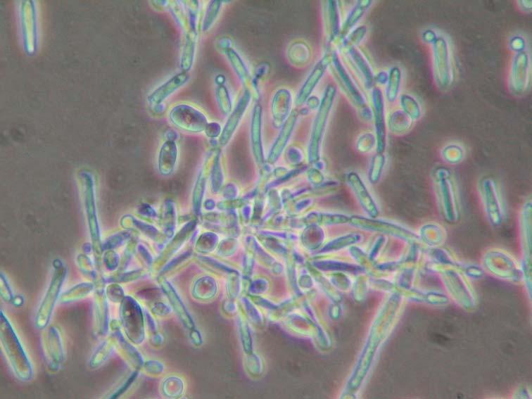 Agenti biologici Batteri Lattici (LAB) Composti antimicrobici