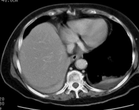 Anatomico (TAC) Misura la densità dei tessuti,