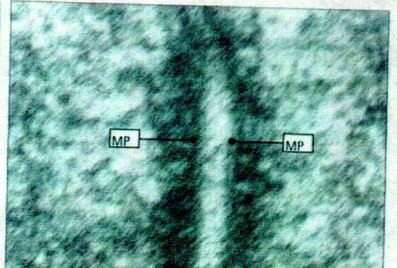 Giunzione occludente Al microscopio elettronico, una giunzione