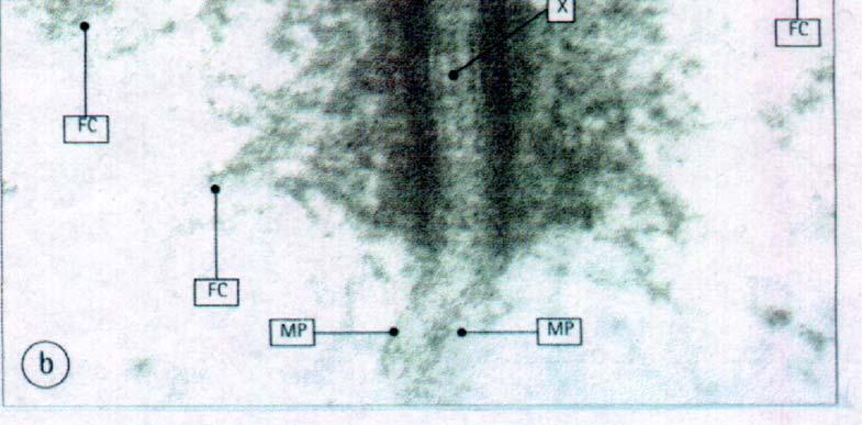 Le membrane plasmatiche (MP) tra le placche di adesione sono distanti circa 30 nm e in alcuni