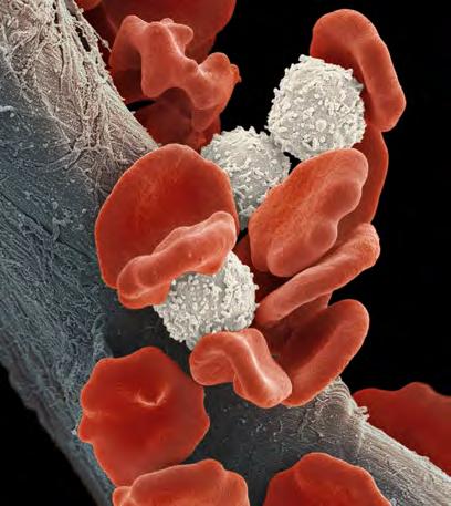 EMATOLOGIA Da sempre Ematologia è sinonimo di DASIT Diagnostica: oltre 30 anni di partnership con il leader di mercato Sysmex, ci consentono di offrire soluzioni adatte a qualunque routine analitica.