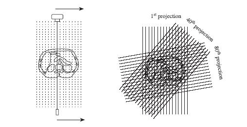 Ricostruzione immagine Raysum misura fatta da ciascun