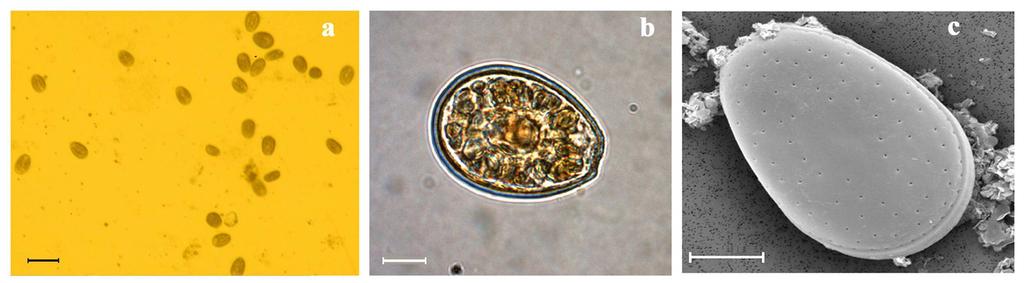 Introduzione Prorocentrum lima (Ehrenberg) Dodge, è una dinoflagellata marina (appartenente alla classe dei dinoflagellati o Dinophyceae), epifitica su macroalghe ed epibentonica su sedimenti o