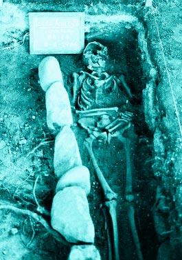 Fig. 1 - Lo scheletro medievale di Isera prima del recupero. trasverso: 68.6). Sicura la presenza del foro orbitale sinistro.
