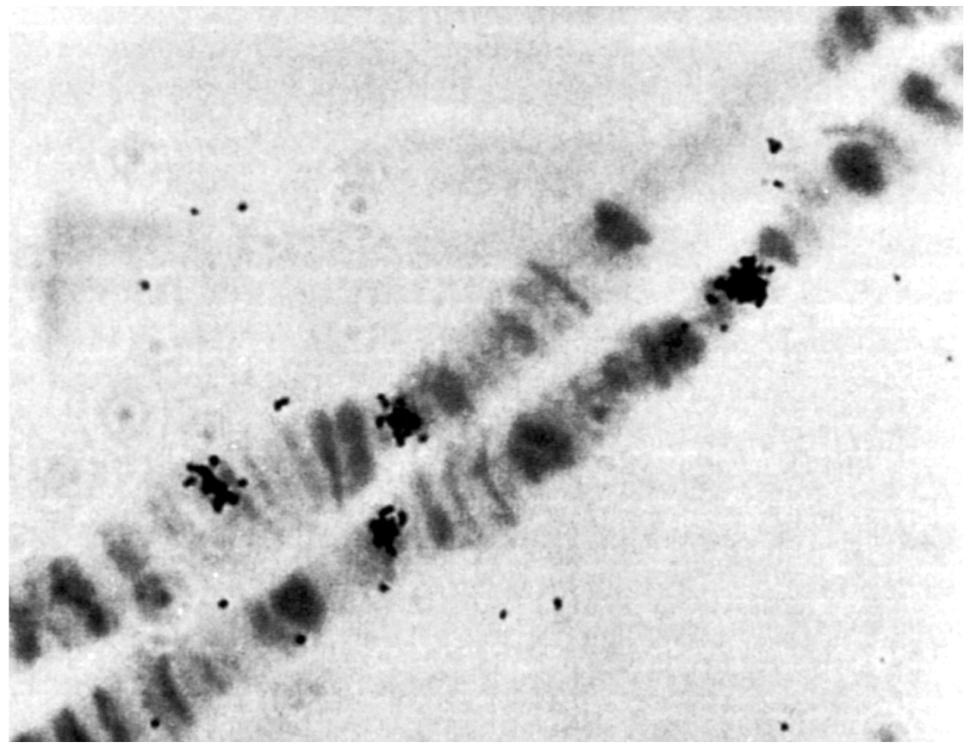 Radioisotopi in biologia e medicina sono usati come traccianti o come fonti di energia distruttiva (radioterapia) devono avere semivita di giorni o mesi non devono accumularsi nell organismo si