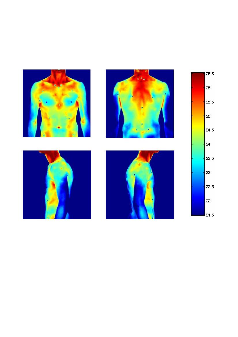 Il soggetto ha una debole scoliosi sinistro convessa a livello toracico, con una lieve rotazione antero-destra ovvero dalla parte della spalla più alta.