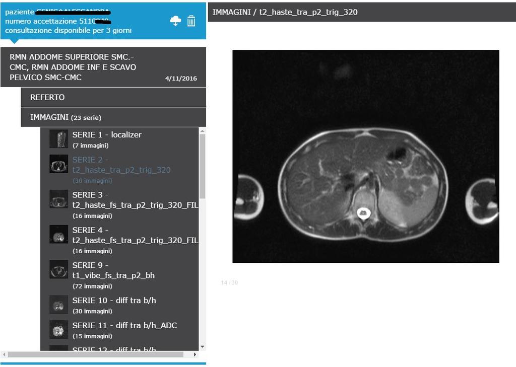 4.2. Visualizzazione delle Immagini Con un click