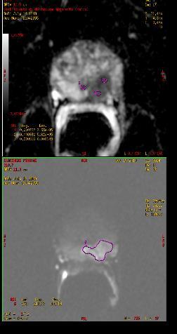 Clinical case (GP) (GP) Patient 61