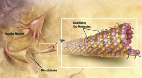 La spaziatura dei neurofilamenti è sensibile al livello di fosforilazione, Sia i microtubuli che i neurofilamenti si fermano ed iniziano nell assone piuttosto che proseguire all interno verso il