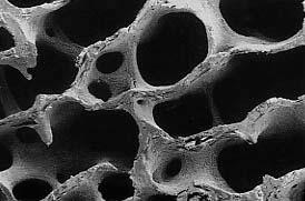 tipi di osso hanno una struttura lamellare: ciascuna lamella è formata da cellule (osteociti) e