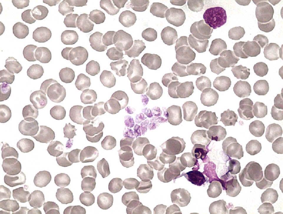 DIAGNOSI DI LABORATORIO La diagnosi può essere effettuata mediante colorazione di Gram. Immunofluorescenza indiretta su biopsie di cuore o di tessuto cerebrale o anche microscopia elettronica.