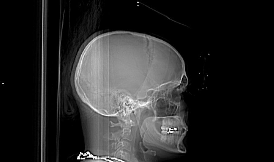 diagnosi radiante Visti i vantaggi,