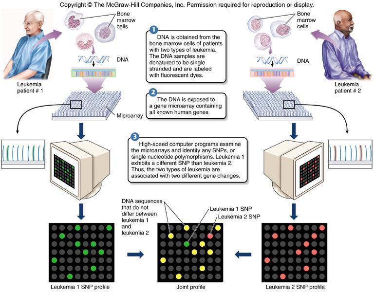 Trascrittomica: analisi dei geni espressi in cellule neoplastiche