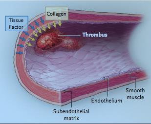 Response to vascular injury Furie B,