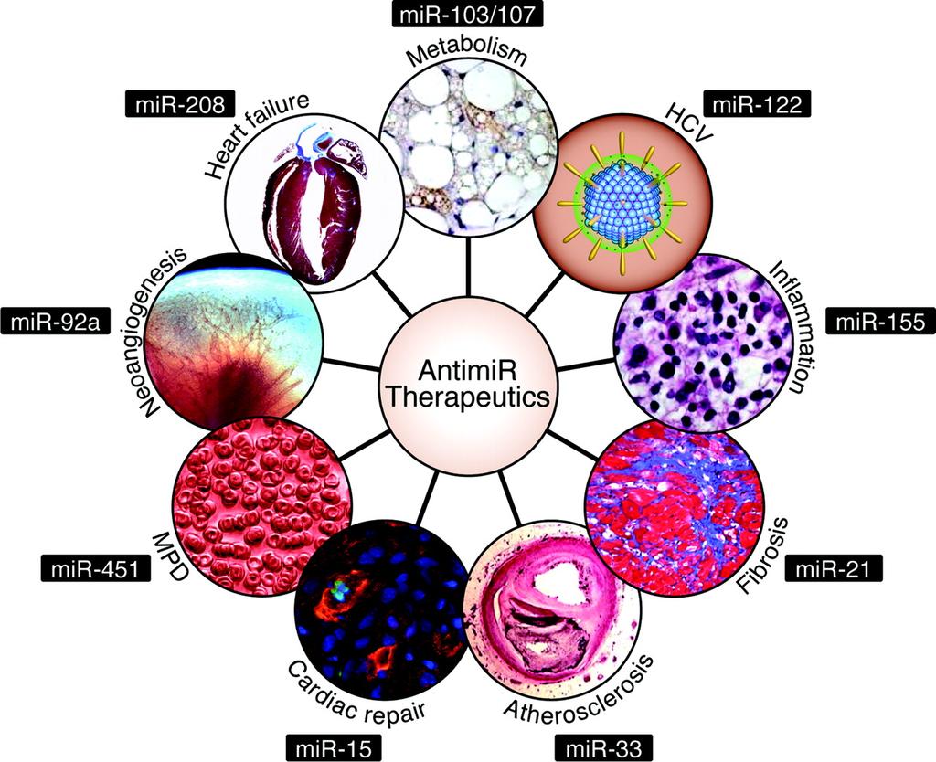 Specific mirnas that are currently being pursued as clinical candidates. van Rooij E et al.