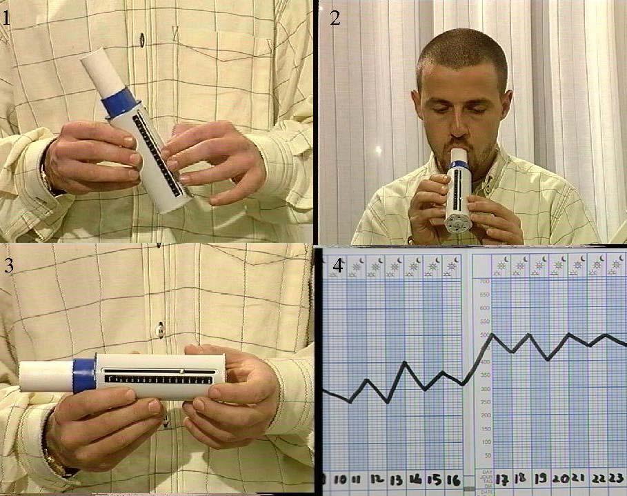 Picco di Flusso Espiratorio Misurazione e significato del picco di flusso Fig 1 e 2 PEF depliant Strumento maneggevole, di poco costo e semplice utilizzo che misura la massima velocità di flusso